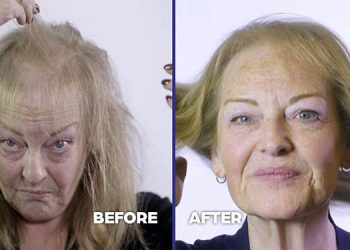 TLC Bolsters Medical Programming Slate with Transformational New Series “Bad Hair Day” [VIDEO]