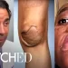 E!’s “Botched” Returns Tuesday, January 25 @ 9:00 PM ET/PT [VIDEO]