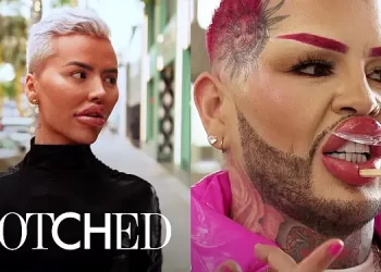 E!’s “Botched” Will Have Everyone in Stitches as Season Eight Premieres on Thursday, August 3 @ 10PM ET/PT [VIDEO]